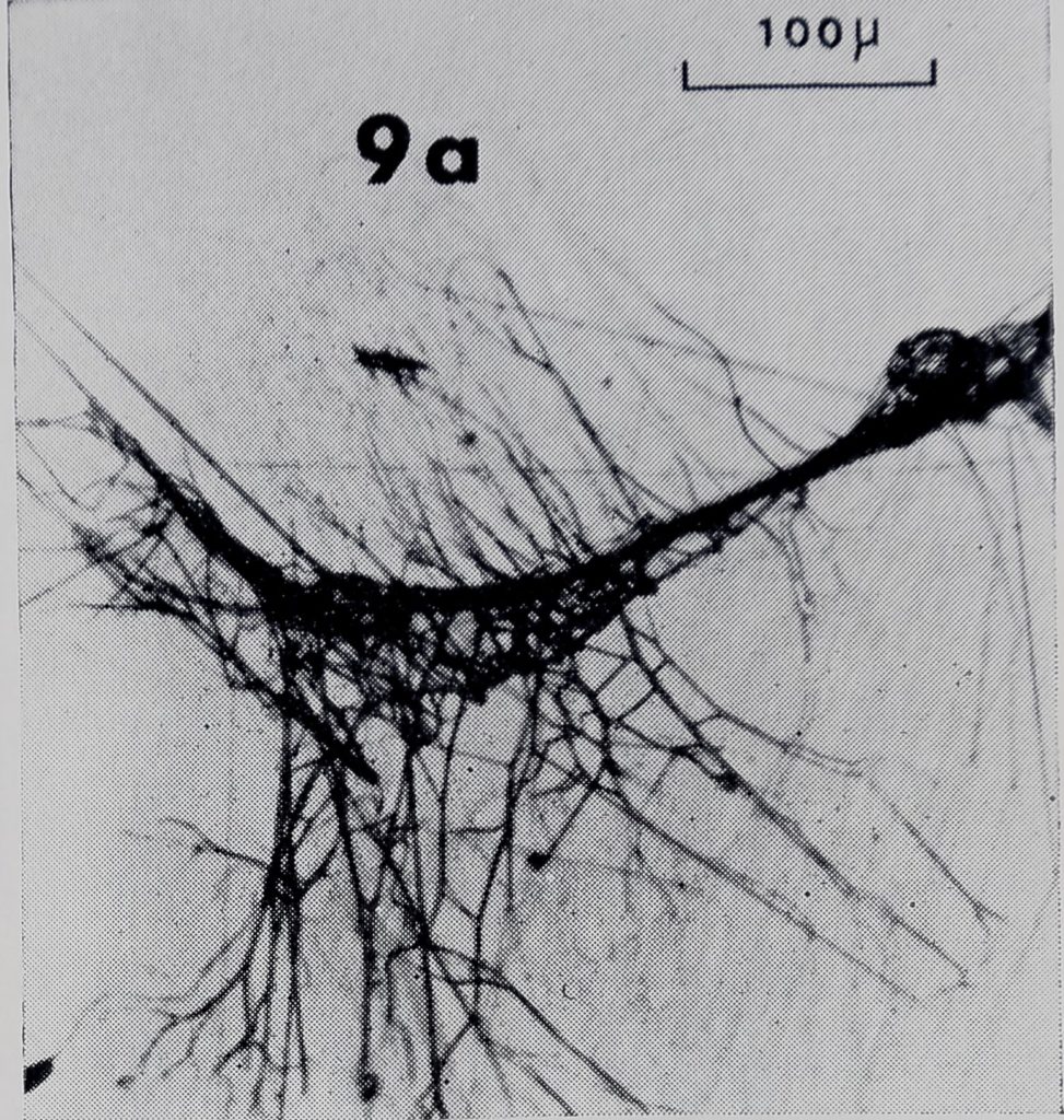 Life on a Thread – Booklet